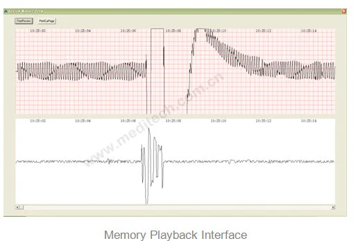 Memory Playback umfasst ECG, grid, speech Wellenform, corresponding time mark, Auto play button, and button for printing current page.