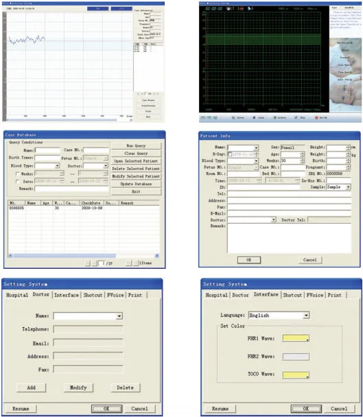 Sonotech Smart ,Fetal doppler Sonde with USB connector,You may Anzeige everything through Sonotech Smart PC software.