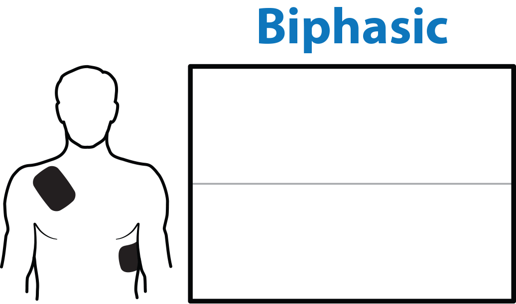 Biphasic Wellenform Animation